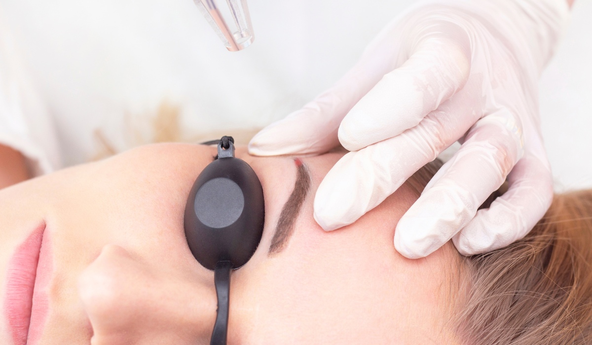 מחיקת איפור קבוע Remover - תהליך הטיפול וההחלמה