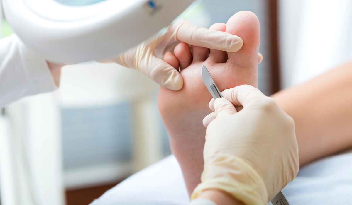 היתרונות המרכזיים של פדיקור רפואי